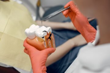 A Complete Guide to Dental Crowns and Bridges